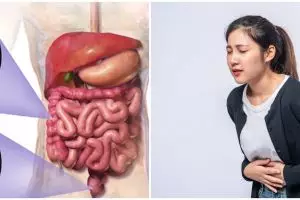 Kenali 7 pemicu kanker usus besar di usia muda, lengkap dengan cara mencegahnya