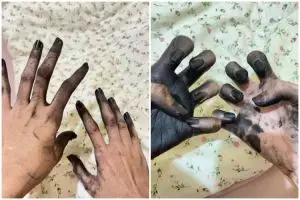 Niat bantu teman malah berakhir apes, kisah cewek hilangkan noda semir di tangan ini penuh perjuangan