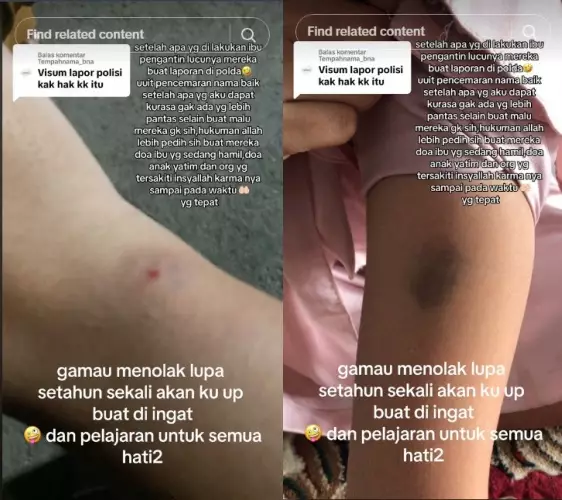 MUA asal Aceh yang dipukul kliennya © TikTok