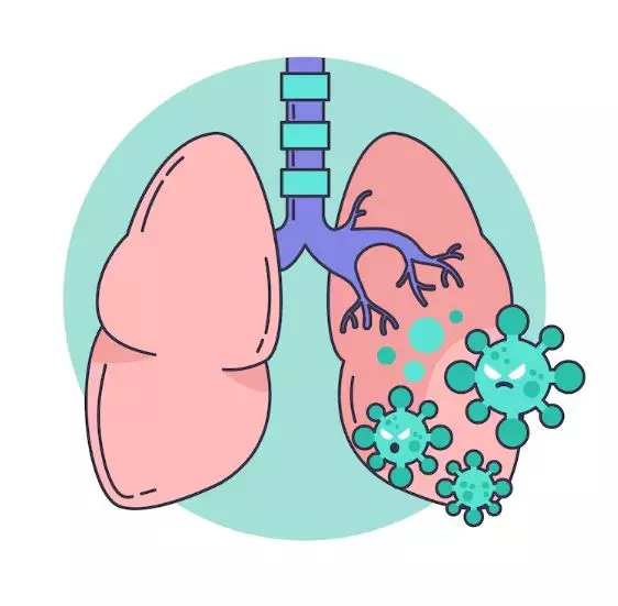 kenali gejala awal paru-paru basa © 2024 brilio.net