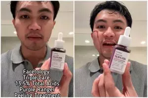 Review Facetology Purple Ranger Peeling diklaim aman untuk usia 16 tahun, bikin cekat cekit nggak?
