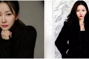 Lucinta Luna akui ketagihan operasi plastik meski taruhannya nyawa, ternyata ini alasannya