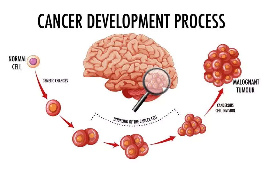 Kenali penyakit tumor hipofisis © 2024 brilio.net Kenali penyakit tumor hipofisis © 2024 brilio.net