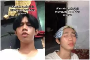Ngide cat rambut sendiri malah berujung trauma, cowok ini alami kerontokan parah sampai harus botak