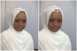 Transformasi cewek kulit gelap dan smile line tebal dirias jadi pengantin ini hasilnya bak beda orang