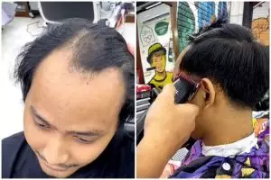 Transformasi pria botak U usai distyling ini hasilnya bikin melongo, auto jadi lebih muda