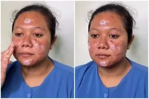 Transformasi cewek wajah breakout penuh jerawat dirias jadi pengantin Jawa ini hasilnya flawless pol