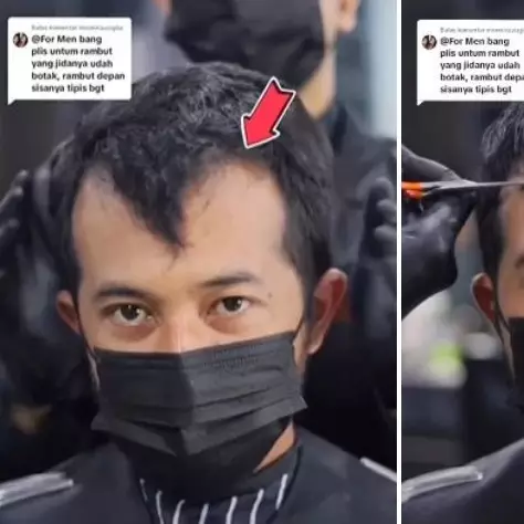 Perubahan pria rambut botak depan usai di styling hasilnya disebut bak beda orang, auto lebih muda