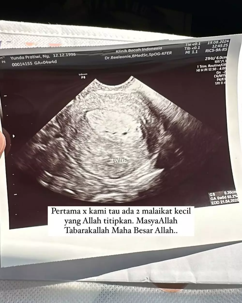 Kisah perjuangan Dennis Lim dan Istri akhirnya garis dua © 2024 Instagram