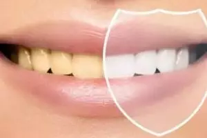 Trik memutihkan gigi kuning dan berkerak tanpa pakai garam, cukup andalkan 1 jenis buah