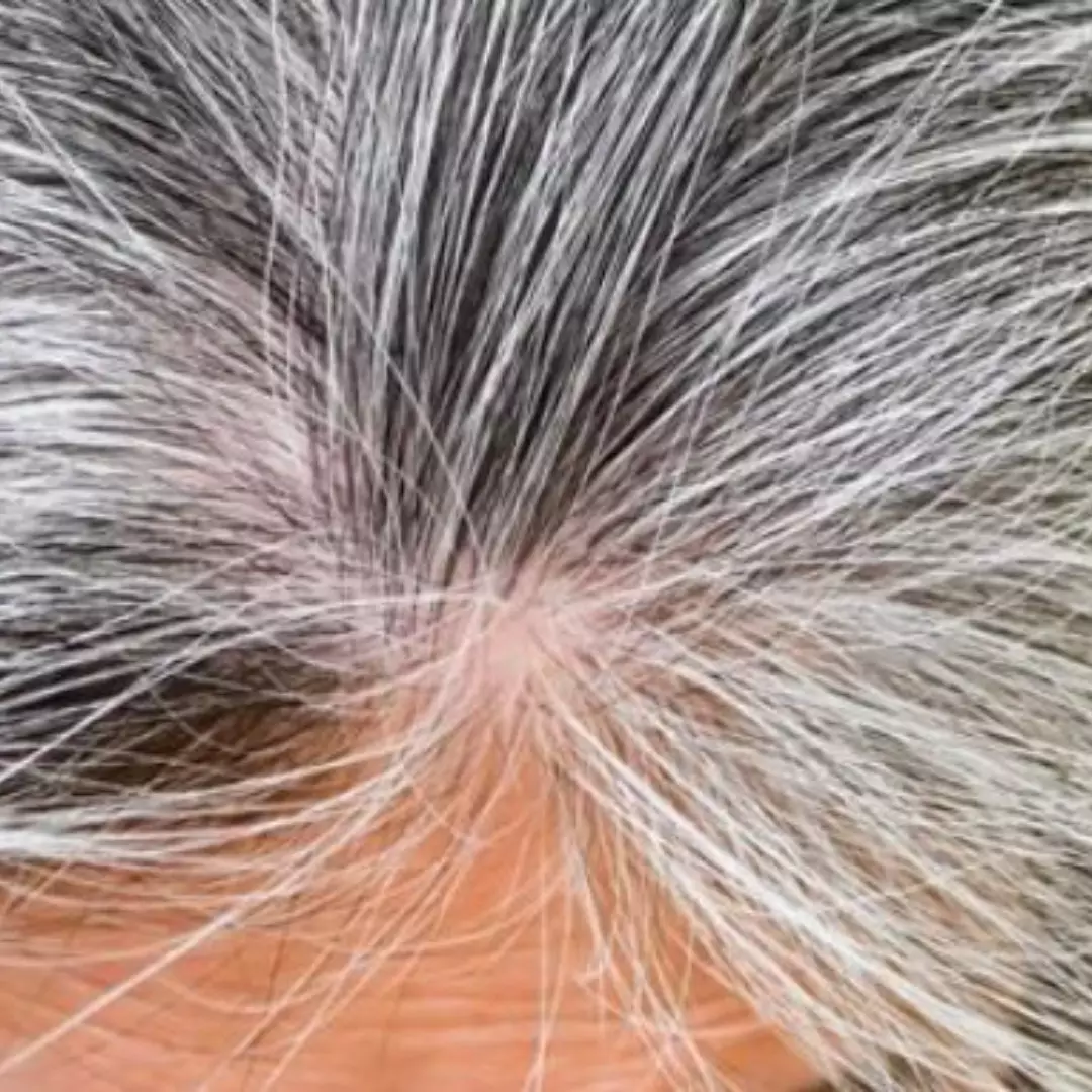 Cara hitamkan uban tanpa semir ini hanya andalkan 3 bahan dapur, nggak perlu pakai jintan