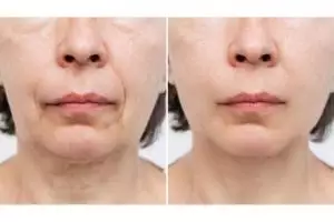 Trik kencangkan wajah kendur agar kembali muda dengan 1 jenis daun, tak butuh putih telur