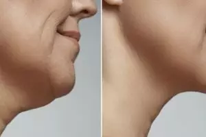 Cara menghilangkan kerutan di wajah mengendur, ampuh bikin kencang dengan 1 jenis sayuran