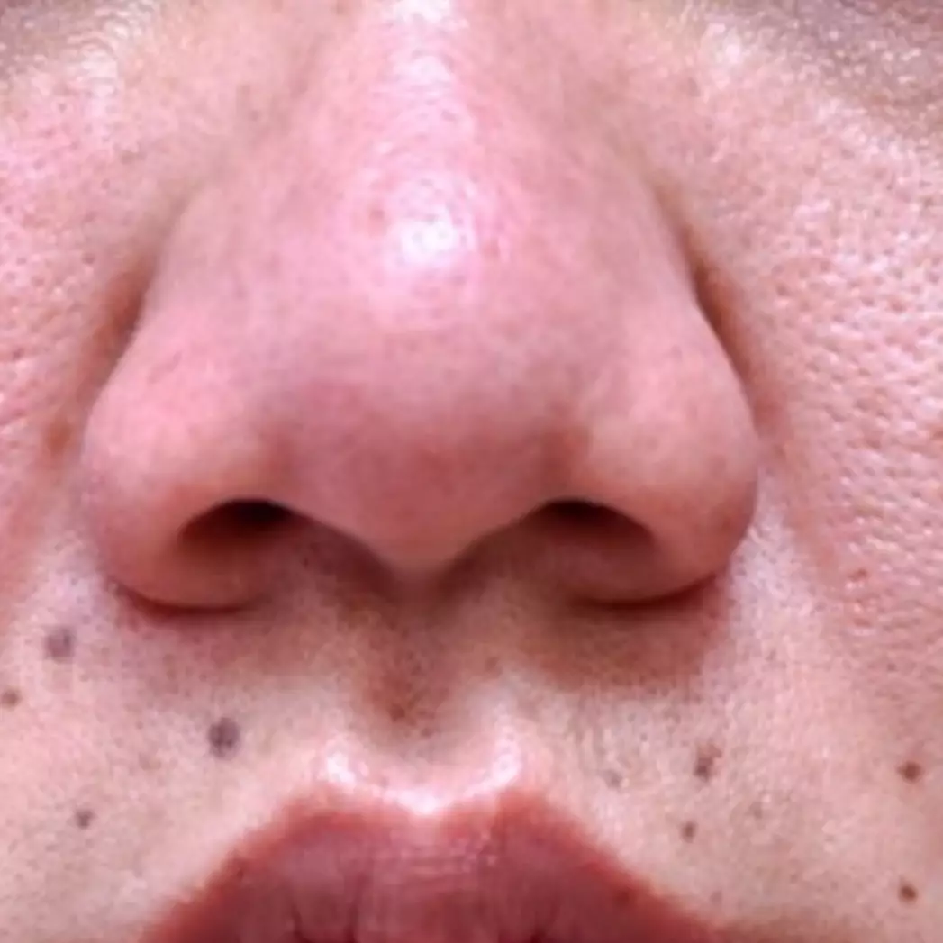 Cara agar tekstur kulit mulus dari pori-pori besar, ampuh cuma andalkan 1 sumber protein