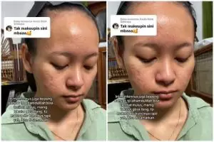 Transformasi cewek wajah bopeng usai dirias jadi pengantin bikin pangling, kulit gradakan auto mulus