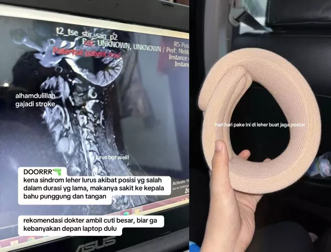 kisah wanita alami sindrom © TikTok kisah wanita alami sindrom © TikTok