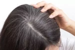 Trik menghitamkan rambut beruban tanpa semir dan urang-aring, andalkan 1 jenis minuman
