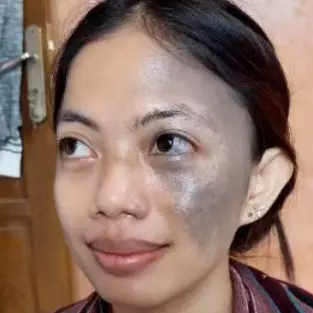 Transformasi cewek dengan tanda lahir hitam di wajah usai dirias pinky makeup ini hasilnya flawless