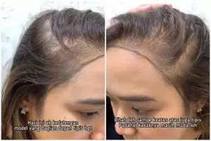 Perubahan cewek rambut tipis usai di styling hasilnya bak pakai wig, tampak lebat tanpa extension