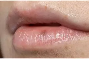 Trik membuat bibir merah ala wanita Korea hanya pakai 1 bahan rempah, ampuh tanpa campuran timun