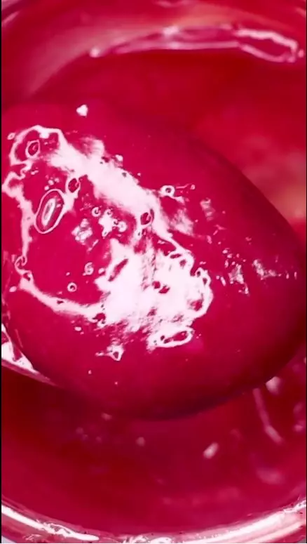 cara mengatasi bibir menghitam agar kembali merah berbagai sumber cara mengatasi bibir menghitam agar kembali merah berbagai sumber