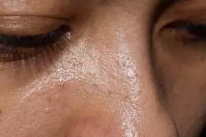 Cara bikin pori-pori kulit rapat dan bebas minyak seharian, ampuh cukup andalkan 1 jenis bunga