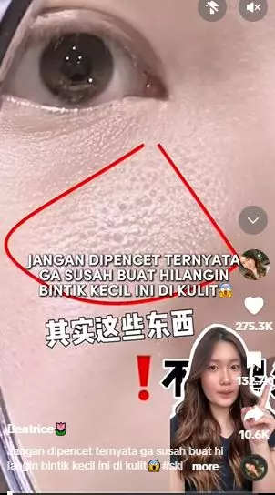 Trik hilangkan bintik-bintik kecil mirip komedo di wajah  TikTok