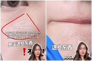 Jangan dipencet, ini trik hilangkan bintik-bintik kecil mirip komedo di wajah agar kulit kembali mulus