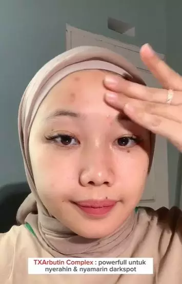 Review Emina Glo Rad Serum diklaim lebih aman dibandingkan produk retinol TikTok