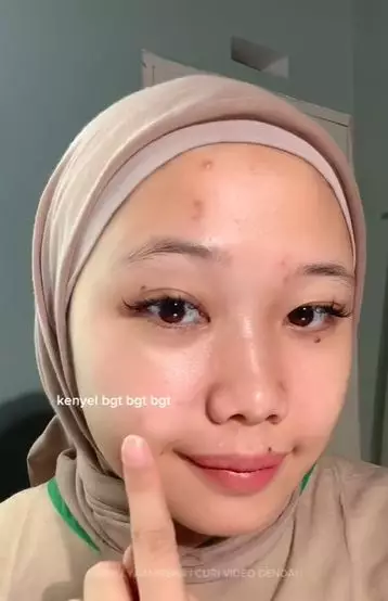 Review Emina Glo Rad Serum diklaim lebih aman dibandingkan produk retinol TikTok