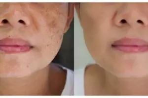 Trik memutihkan kulit kusam penuh daki tanpa pakai lulur, ampuh cuma andalkan 1 jenis buah