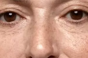 Trik menghilangkan flek hitam tanpa laser wajah, langsung cerah cuma andalkan 1 jenis buah