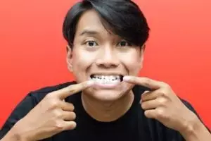 Trik pudarkan karang gigi tanpa perlu scaling, ampuh cuma andalkan 1 bahan dapur