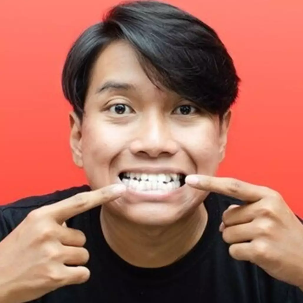 Trik menghilangkan karang gigi membandel, ampuh cuma andalkan 1 bahan makanan