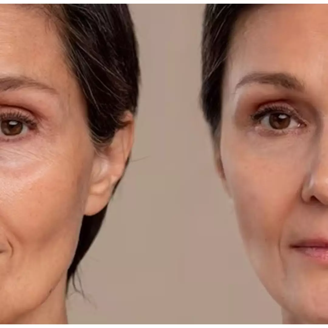 Cara kembalikan elastisitas kulit, ampuh bikin tak keriput cuma andalkan 1 jenis buah