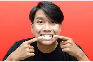 Tak perlu kayu manis, begini cara ampuh hilangkan karang gigi dengan andalkan satu bahan makanan 