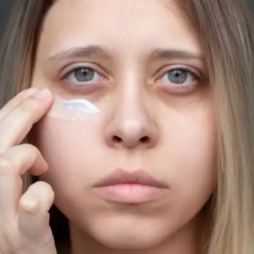 Nggak perlu eye cream, 1 jenis buah ini ternyata bisa mengatasi kerutan dan mata panda