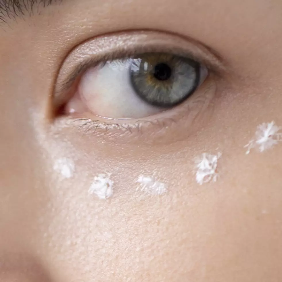 Hasilnya terlihat dalam seminggu, begini cara hilangkan mata panda hanya pakai 1 jenis rempah