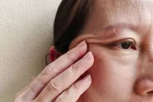 Tak perlu aloe vera, begini cara bikin kulit kendur tampak lebih kencang pakai 1 bahan pembuat kue