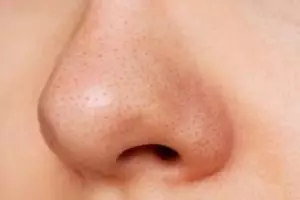 Kulit halus tanpa komedo, ini trik kecilkan dan bersihkan pori-pori wajah dengan 1 jenis tepung