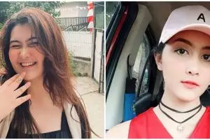 Cerita perjuangan Talitha Curtis lawan penyakit mental hingga berat badannya naik ini bikin pilu