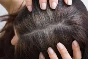 Hitam merata tanpa rambut putih, ini cara mengurangi tumbuhnya uban prematur pakai 1 jenis biji-bijian