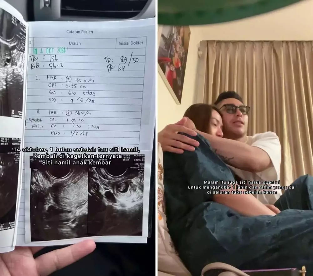 siti badriah alami kehamilan di luar rahim © 2024 Instagram