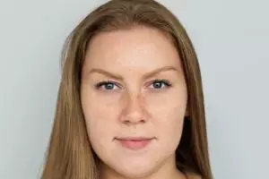 Tanpa serum vitamin C, kombinasi baking soda dan 1 jenis minyak ini ampuh pudarkan flek hitam di wajah