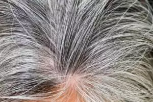 Tak cuma pakai kopi, ini cara menghambat tumbuhnya uban dengan tambahan 1 jenis minyak alami