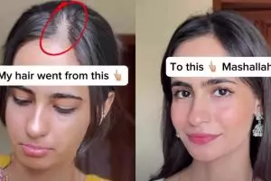 Trik hentikan kerontokan rambut dengan hair mist dari 1 jenis daun, ampuh tanpa urang-aring