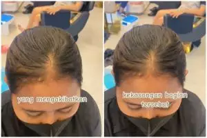 Transformasi cewek botak depan usai di styling hasilnya bak beda orang, auto lebat tanpa tanam rambut