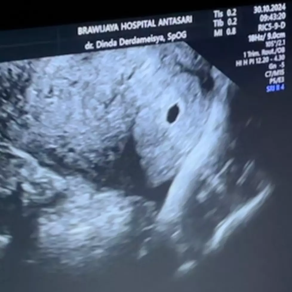 momen kebahagiaan Tora Sudiro © 2024 brilio.net momen kebahagiaan Tora Sudiro © 2024 brilio.net