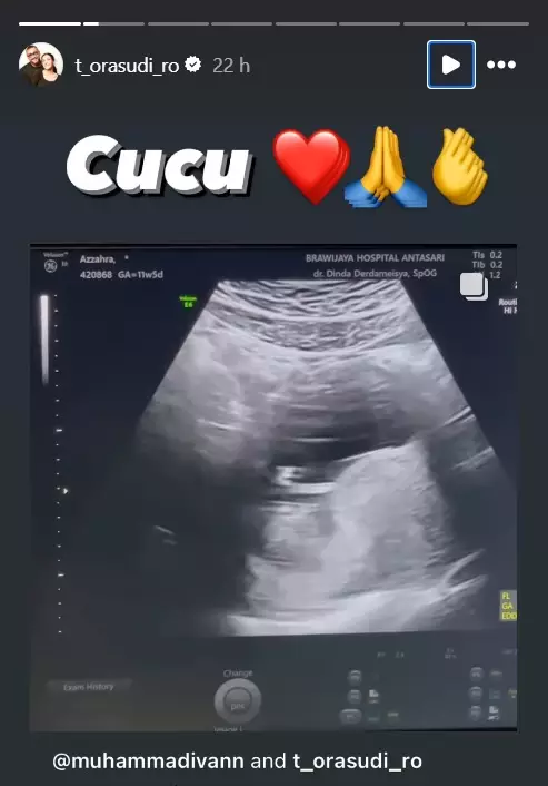 momen kebahagiaan Tora Sudiro © 2024 brilio.net momen kebahagiaan Tora Sudiro © 2024 brilio.net