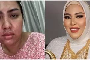 Usianya baru 30 tahun tapi gayanya emak-emak sosialita, 9 potret dulu & kini bos skincare Mira Hayati